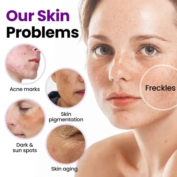 SpotRefiner Probiotic Shield Serum - Image 10