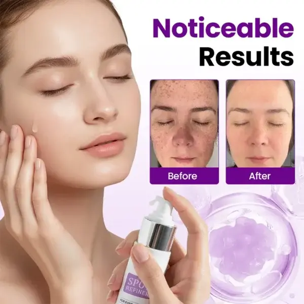 SpotRefiner Probiotic Shield Serum - Image 7