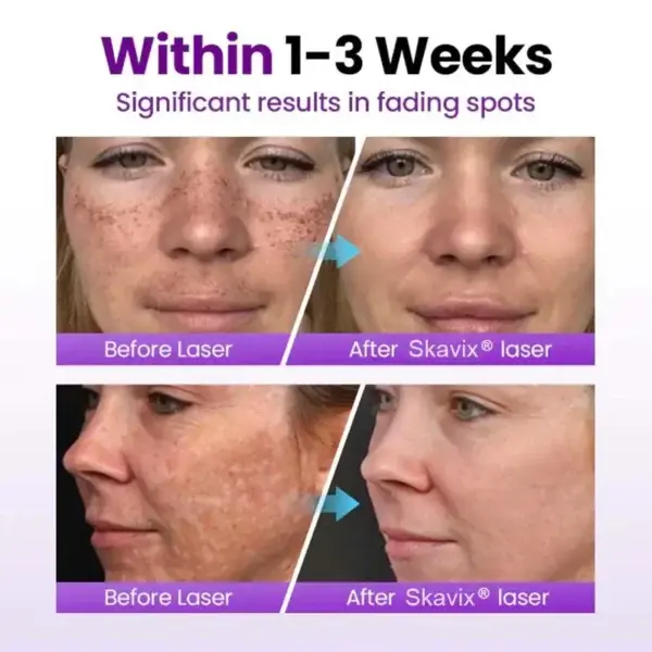 SpotRefiner Probiotic Shield Serum - Image 8