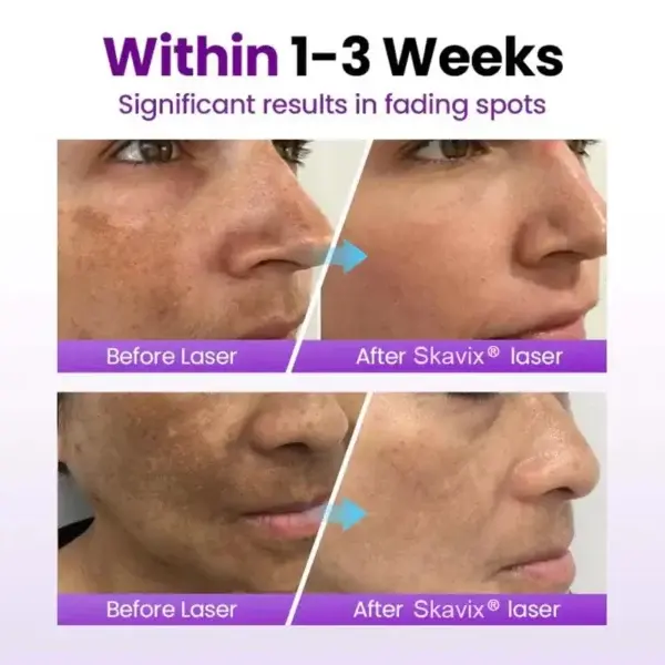 SpotRefiner Probiotic Shield Serum - Image 9