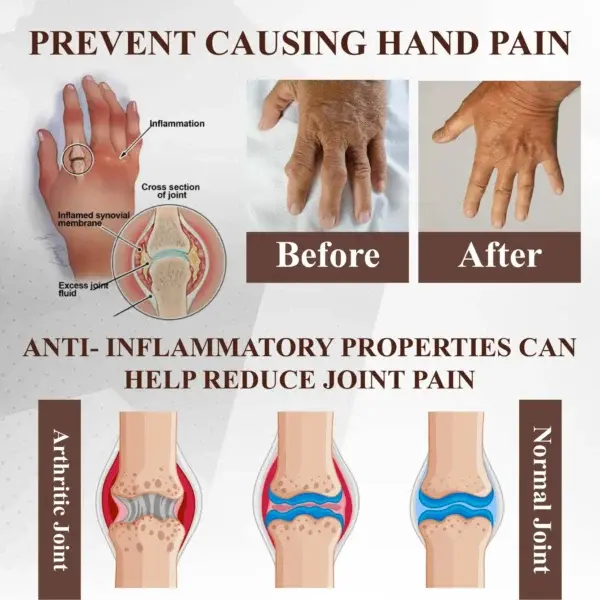 Emu Oil Turmeric Bone Sooth Gel - Image 8