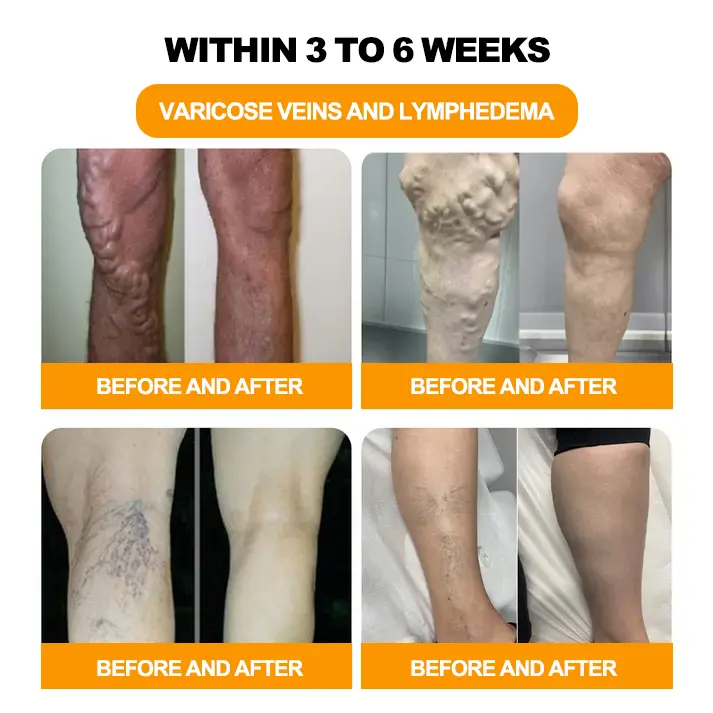 30-Herb Slimming & Detox Foot - Image 5