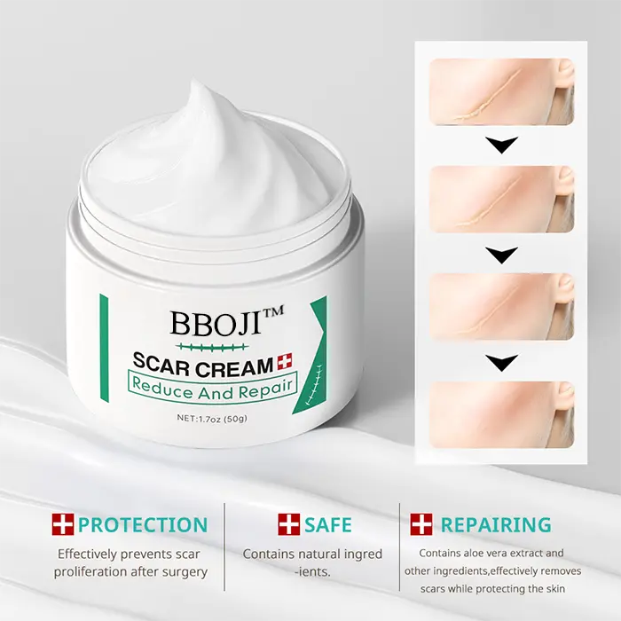 Scar Removal Cream - Image 3