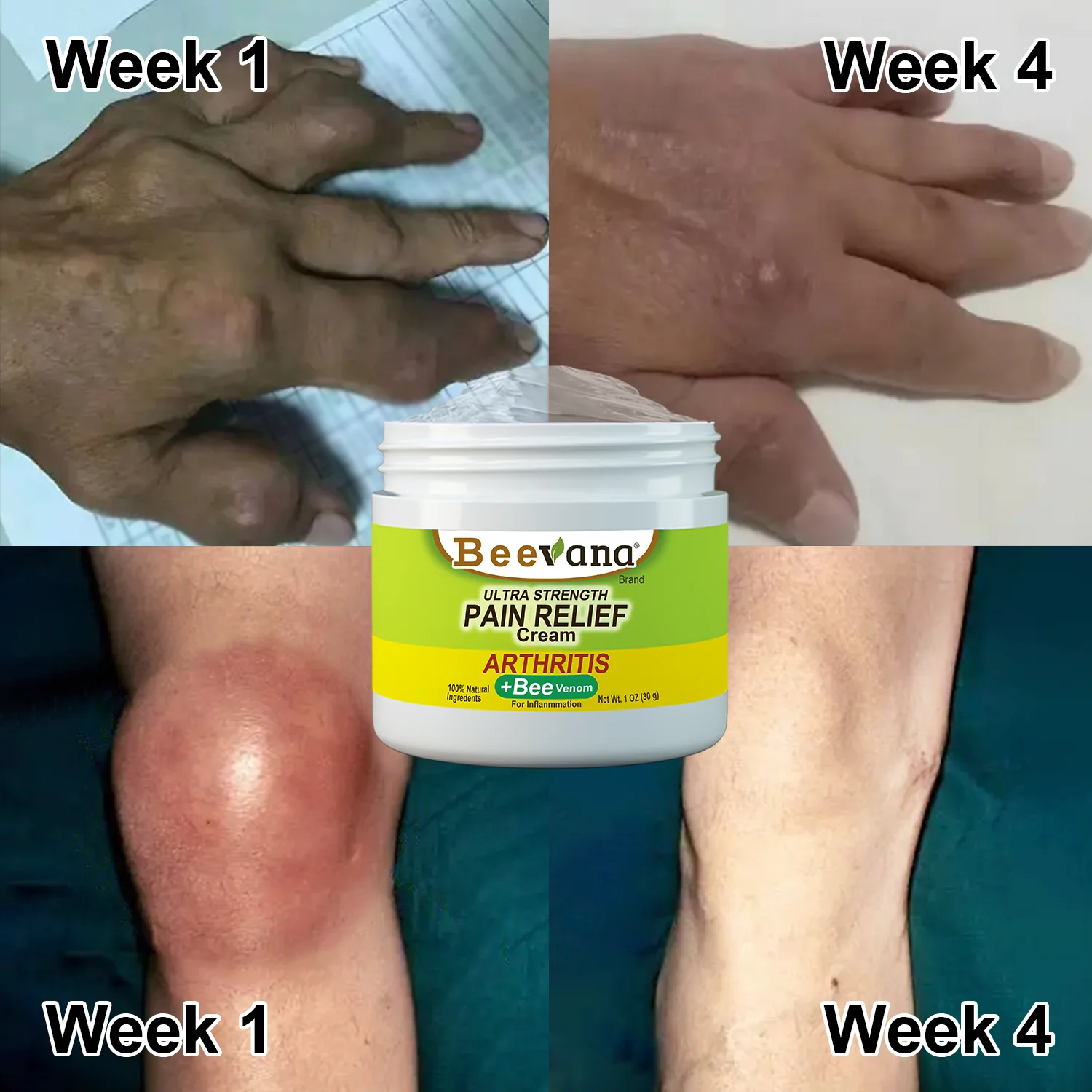 Bee Venom Joint & Bone Therapy Cream - Image 5