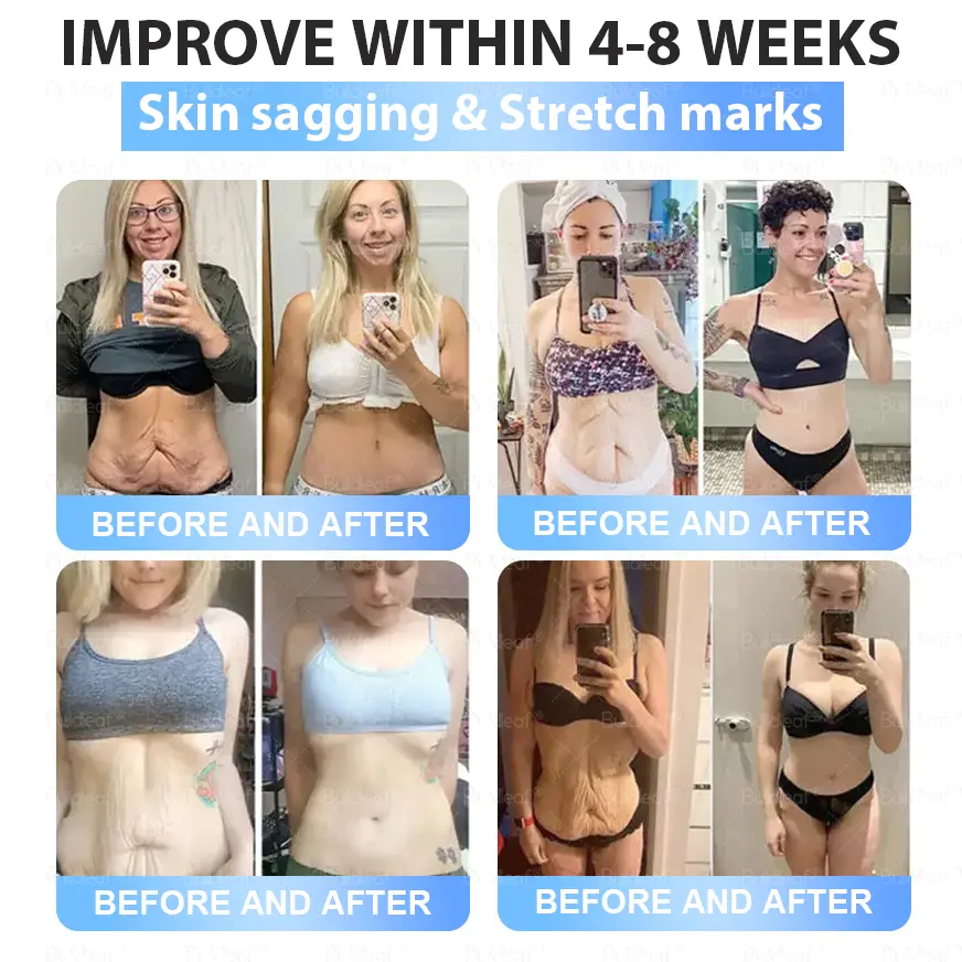 Slimming Patch with Collagen - Image 5