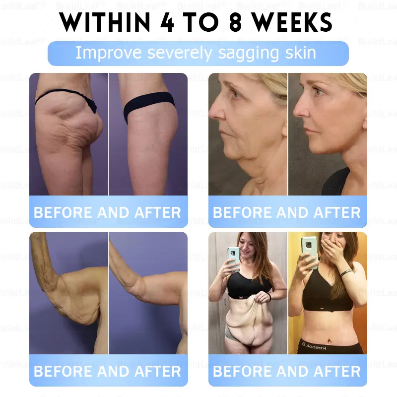 Slim & Firm Nano Microneedle Patch with Collagen - Image 8