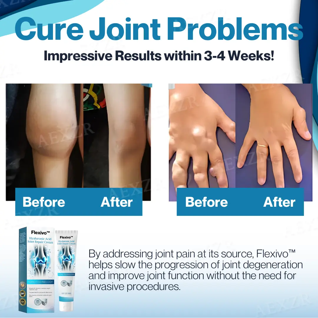 Hyaluronic Acid Joint Repair Cream - Image 2
