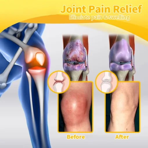 Bee Venom Joint and Bone Cream - Image 8