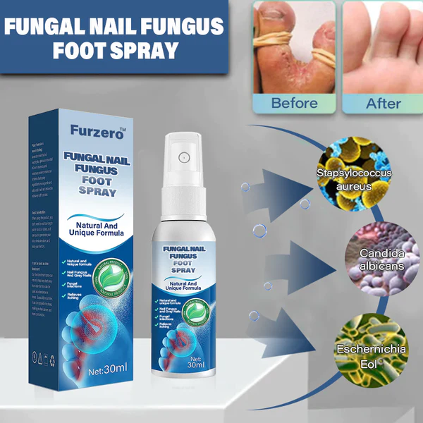 Medical grade fungal nail fungus foot spray - Image 5