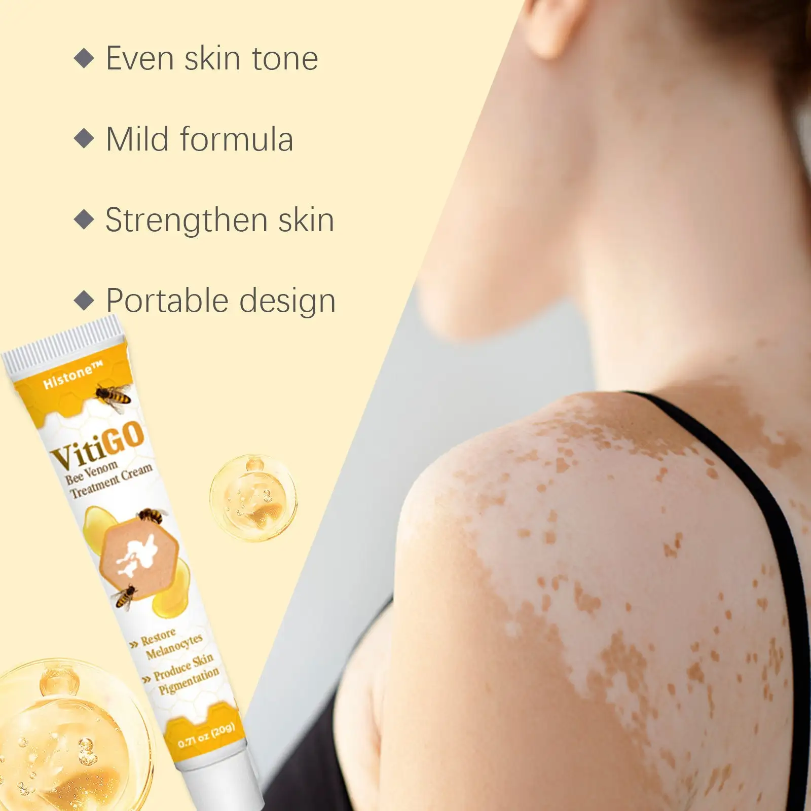 VitiGO Bee Venom Treatment Cream - Image 2