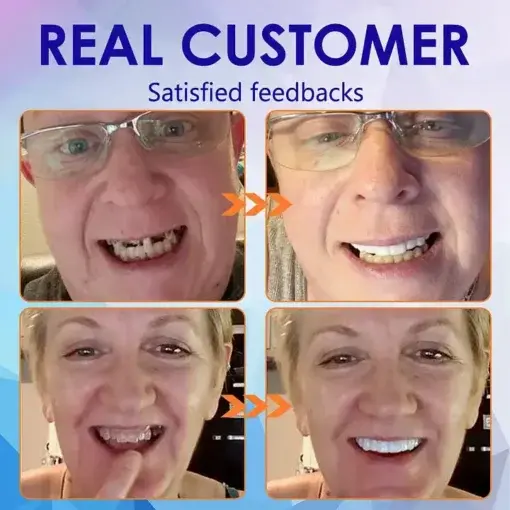 - Advanced Customized Full Denture Set - Image 11