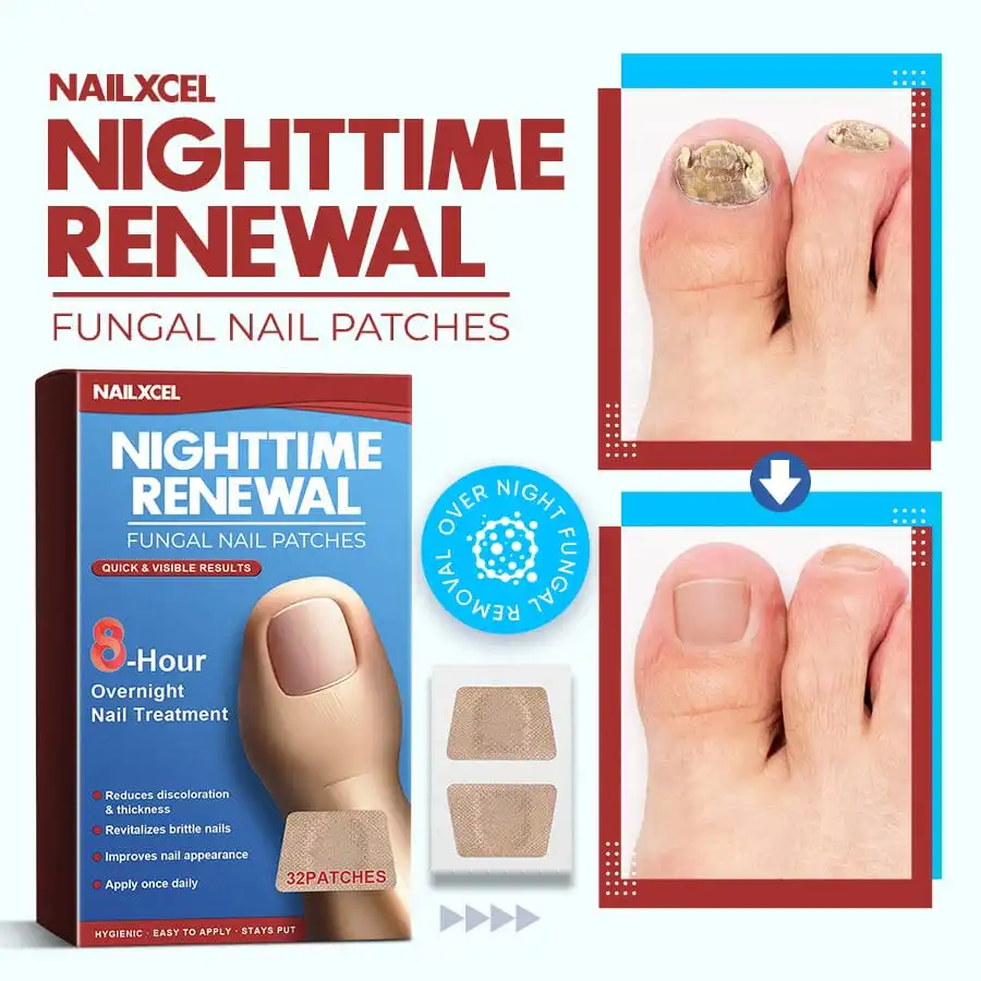 NailXcel Nighttime Renewal Fungal Nail Patches