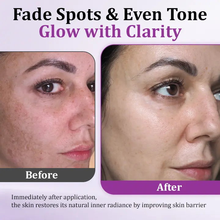 MelantraX Advanced Anti-Hyperpigmentation Essence - Image 4