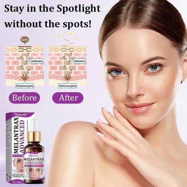 MelantraX Advanced Anti-Hyperpigmentation Essence - Image 6