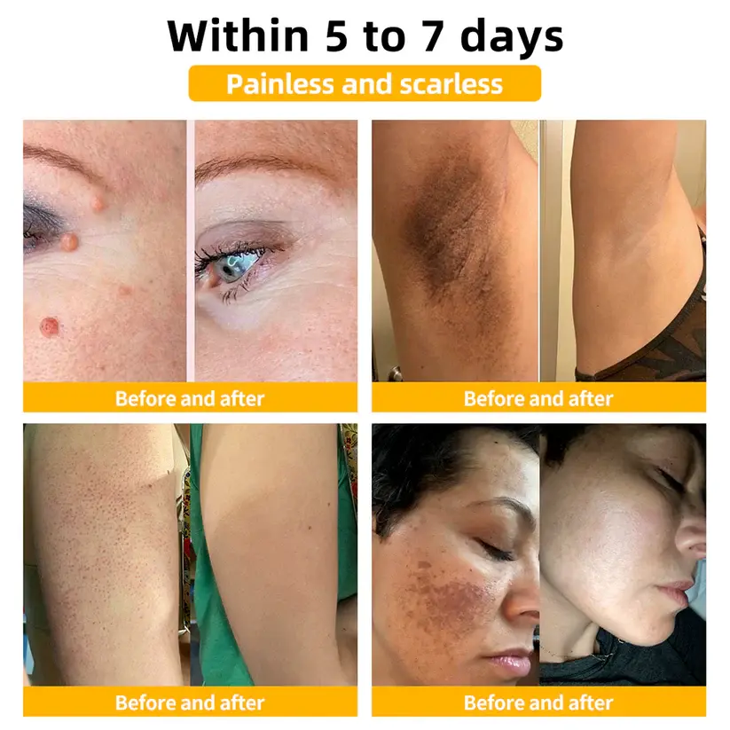 Bee Venom Multi-Action Skin Repair Cream - Image 4