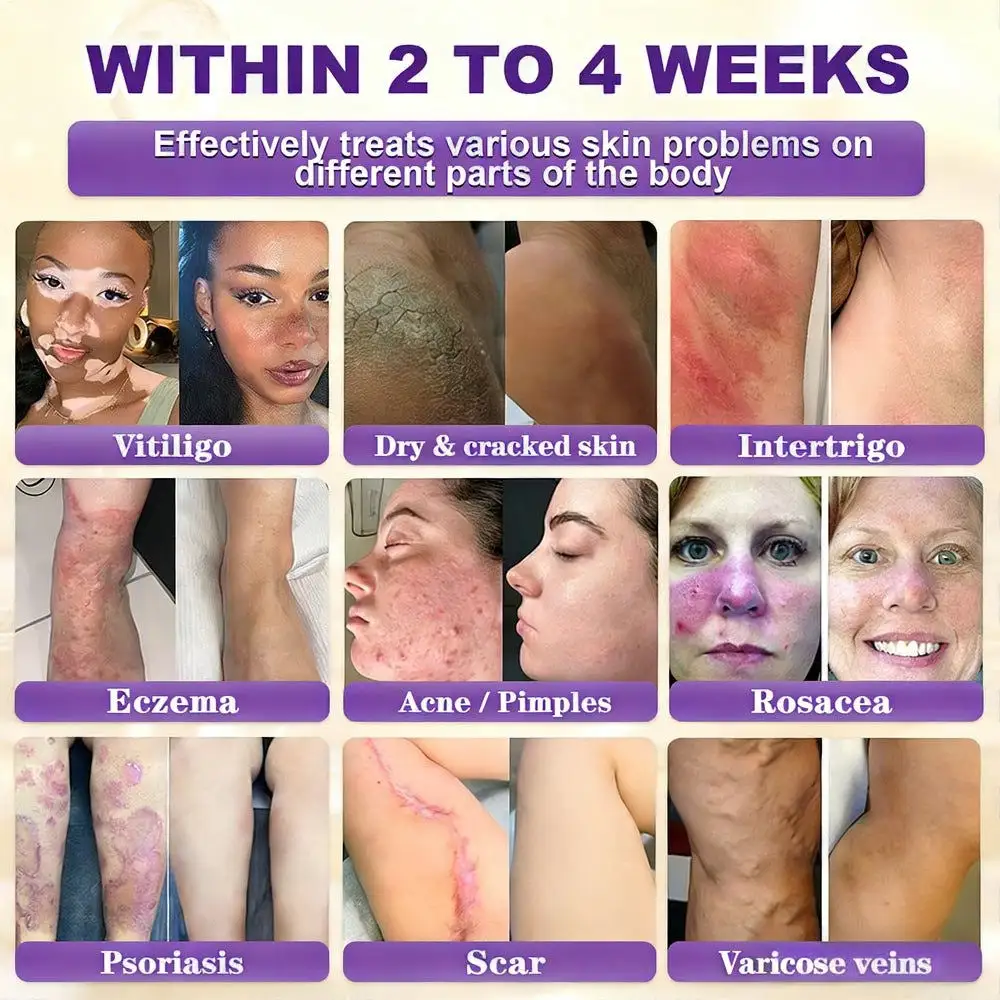 Biotin 10-in-1 Skin Repair Cream — Last Day of Sale: 75% Off - Image 2