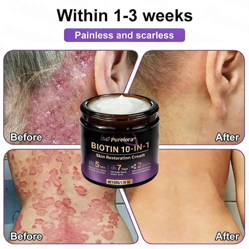 Biotin 10-in-1 Skin Repair Cream — Last Day of Sale: 75% Off - Image 5