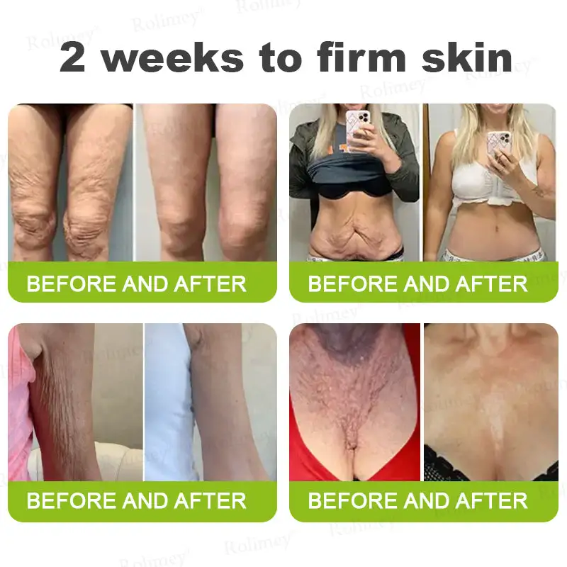 Botox & Vita-A Retinol Shot Wrinkle-Lift Tightening cream - Image 3