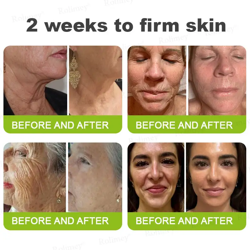 Botox & Vita-A Retinol Shot Wrinkle-Lift Tightening cream - Image 6