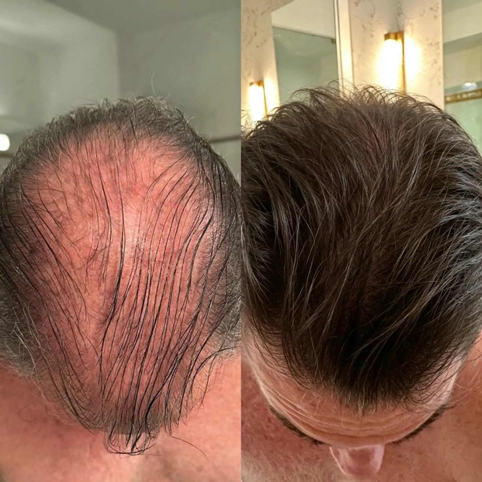Onion & Rosemary 2-in-1 Shampoo & Conditioner with 15X Active Complex for Hair Growth - Image 4