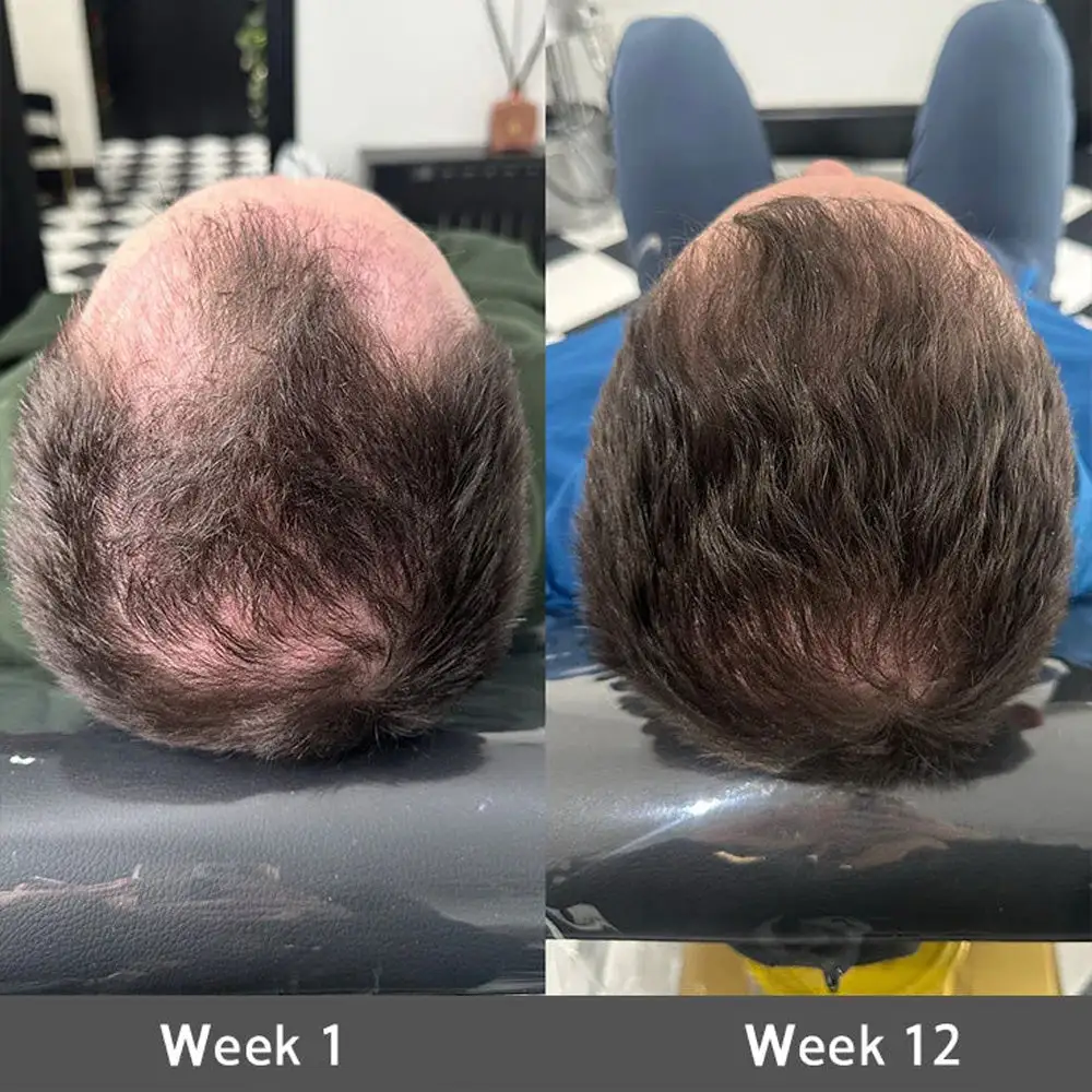 Onion & Rosemary 2-in-1 Shampoo & Conditioner with 15X Active Complex for Hair Growth - Image 7