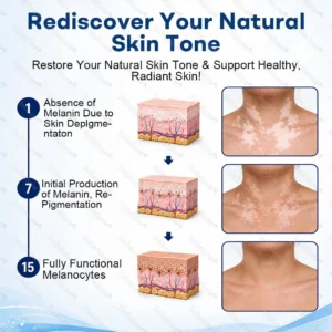 Alternative view of Advanced Piperine Vitiligo Repigmentation Spray