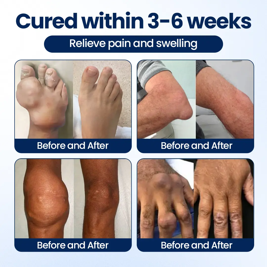 ArthriNAD+ Pro Advanced Joint Recovery Cream - Image 8