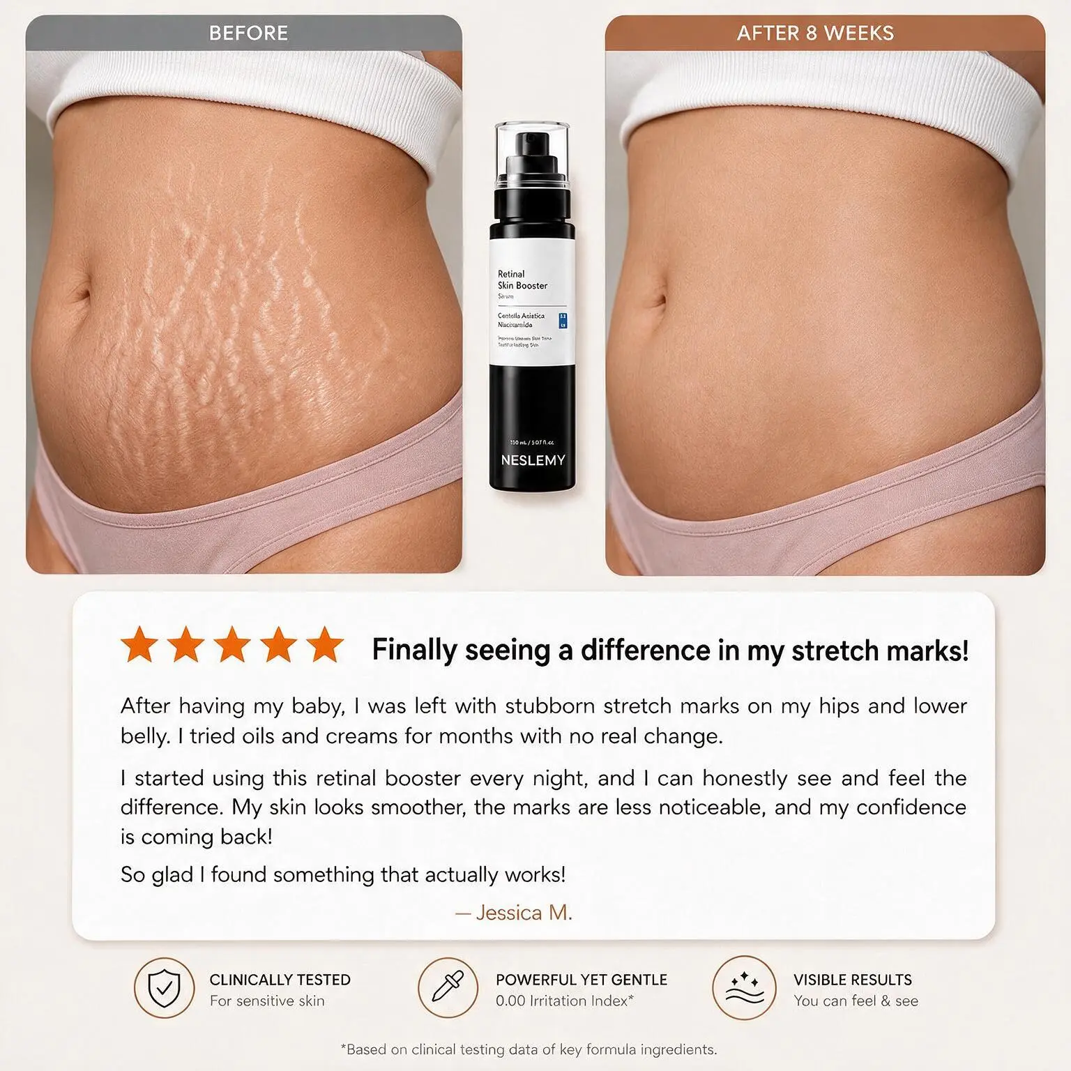 NESLEMY Advanced Retinal Stretch Mark Serum - Image 5