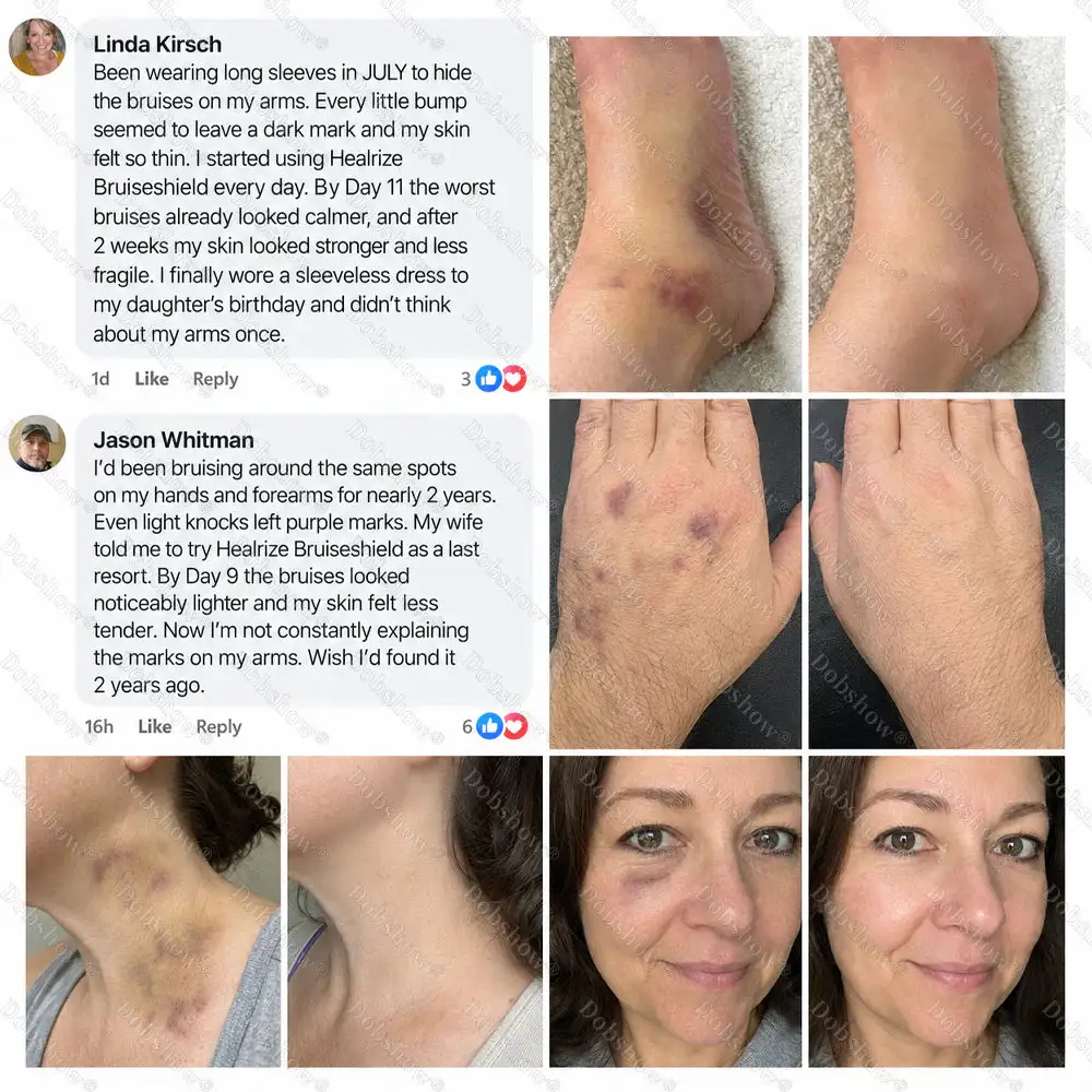 Bruise Shield & Skin-Strengthening Cream - Image 2