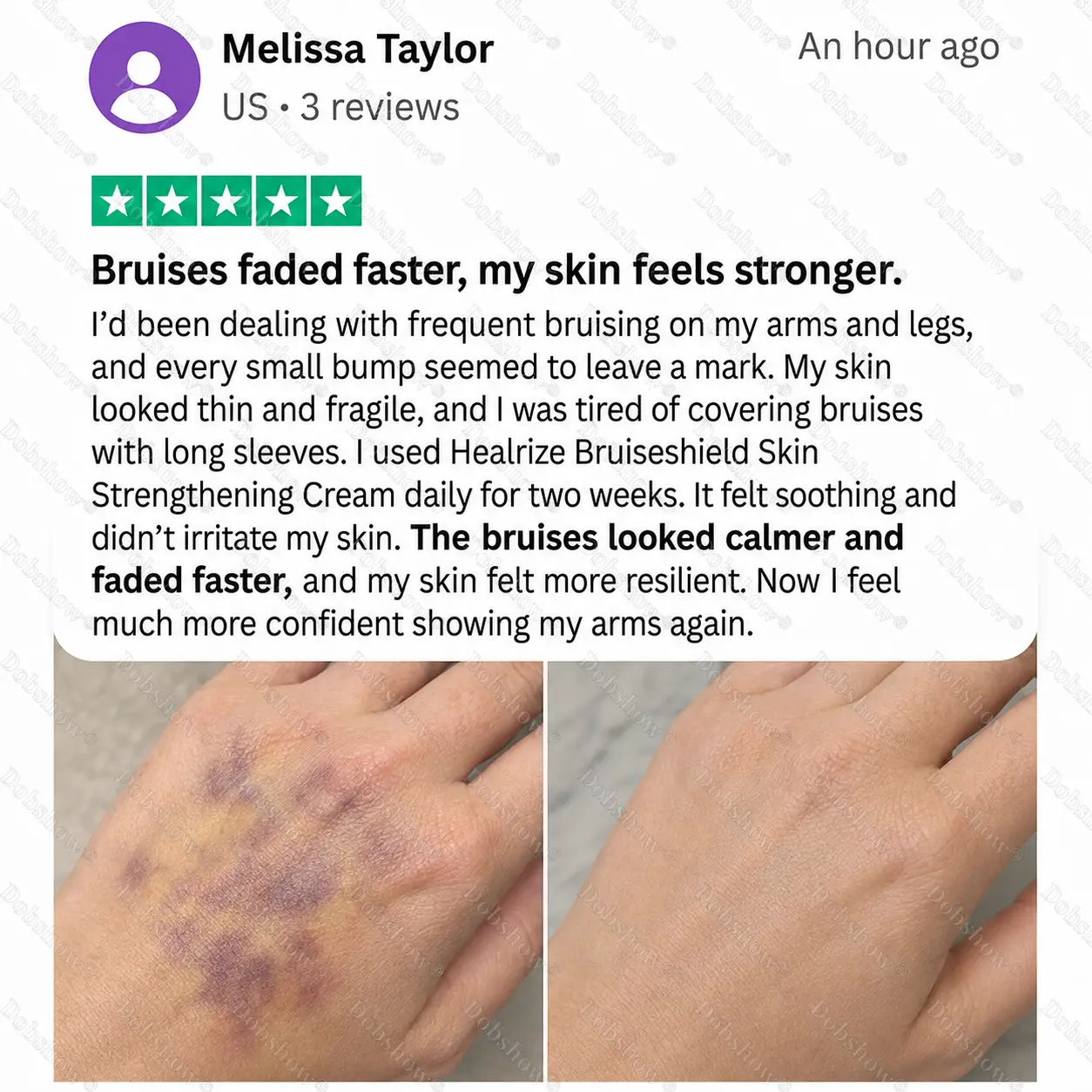 Bruise Shield & Skin-Strengthening Cream - Image 4
