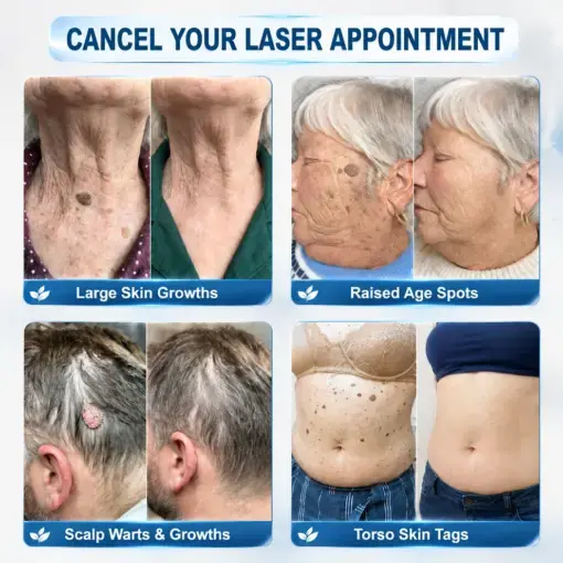 7-Day Precision Rollerball - Image 2