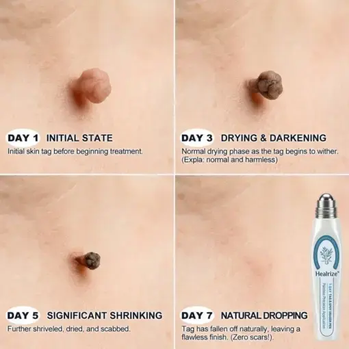 7-Day Precision Rollerball - Image 4