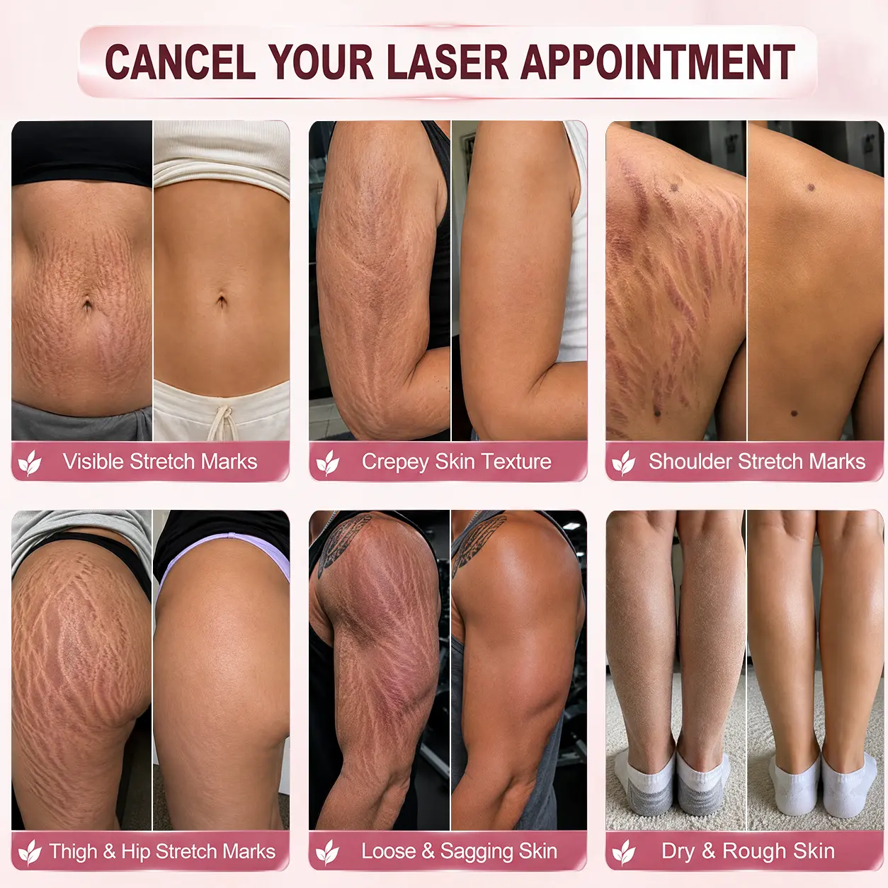 7-Day Skin Transformation Body Stick - Image 2