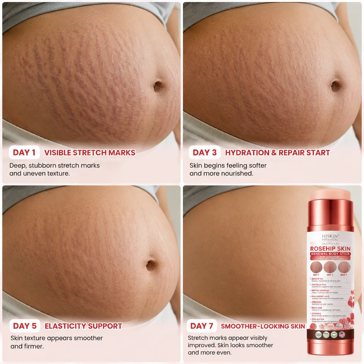 7-Day Skin Transformation Body Stick - Image 6