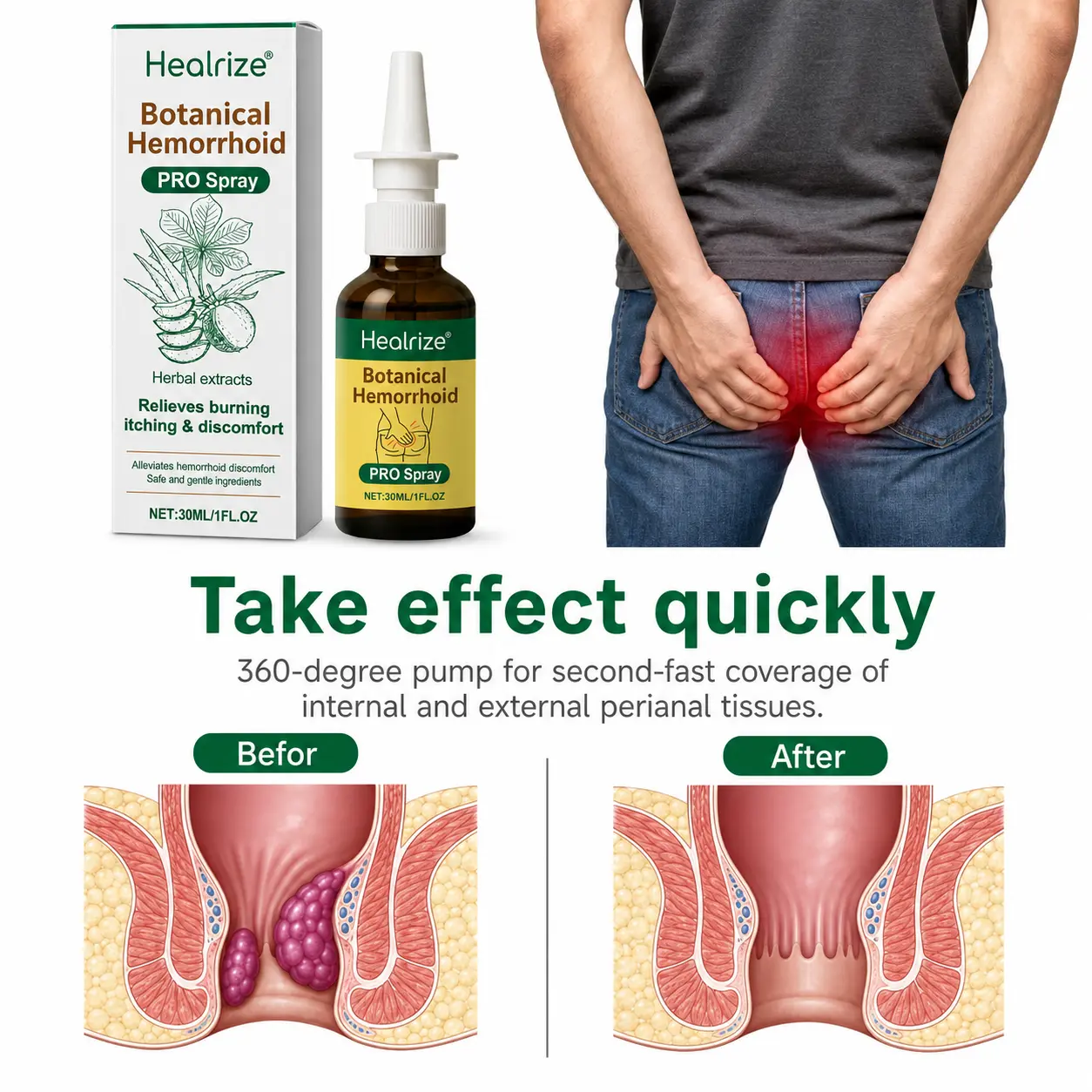 Botanical Hemorrhoid PRO Spray - Image 6