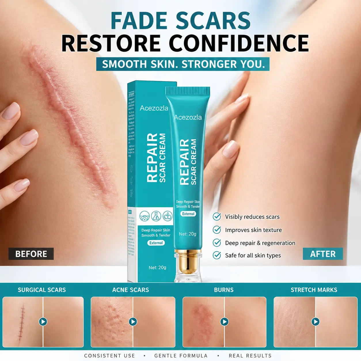 Repair Scar Cream