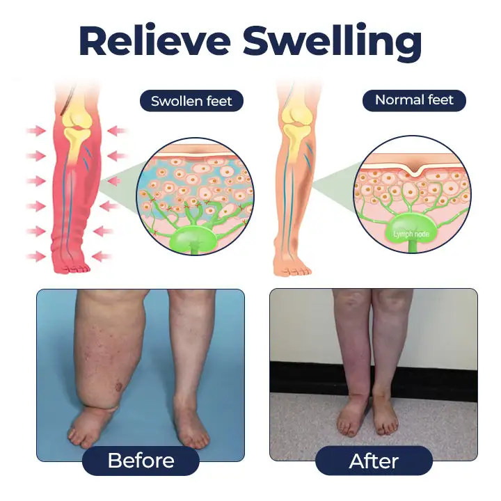 SwellRelief Circulation Support Cream - Image 4