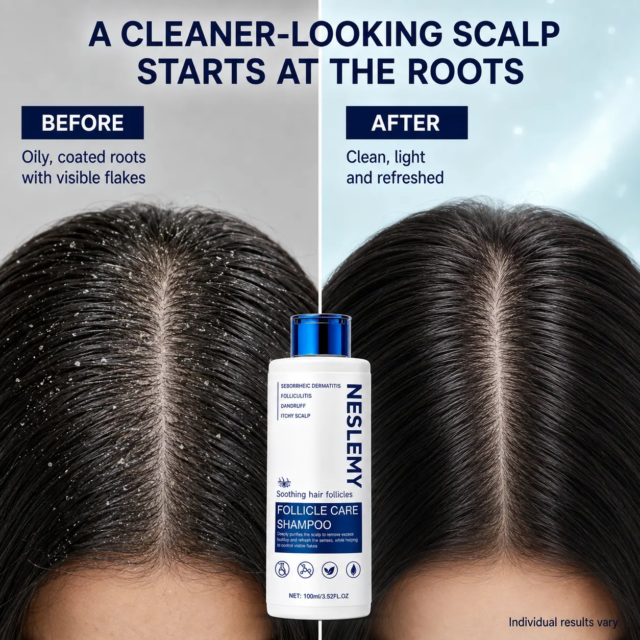 NESLEMY Folliculitis Shampoo for Itchy - Image 14