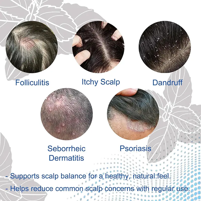NESLEMY Folliculitis Shampoo for Itchy - Image 2