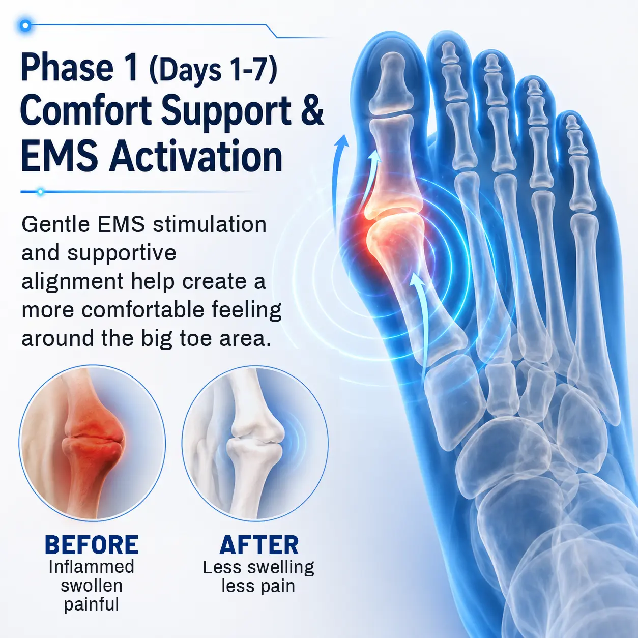 FootAlign EMS Pro - Advanced EMS Foot Support System - Image 10
