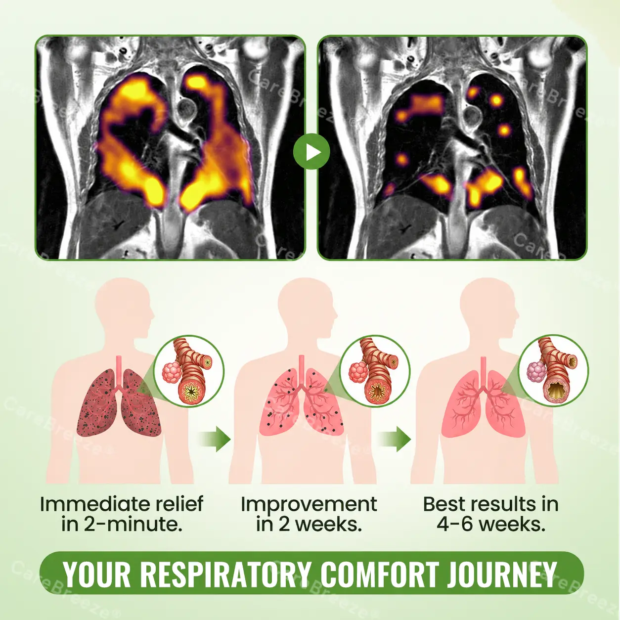 Advanced Botanical Mullein Lung Cleanse Melt Strips - Image 5