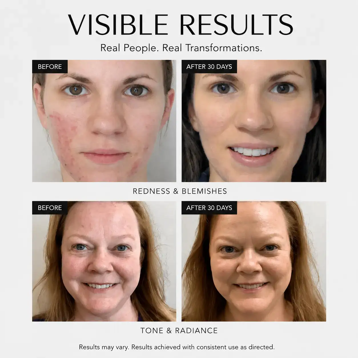 Rosacea Corrector - Image 2