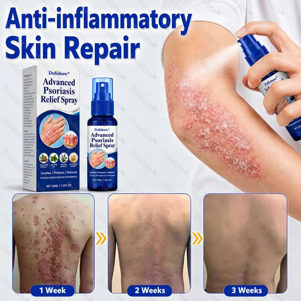 Advanced Psoriasis Relief Spray - Image 4