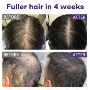 Alternative view of Black Rice & Red Onion Hair Growth Spray