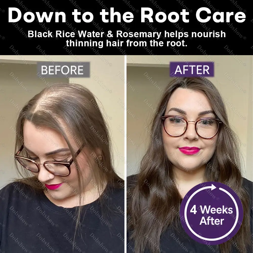Black Rice & Red Onion Hair Growth Spray - Image 4