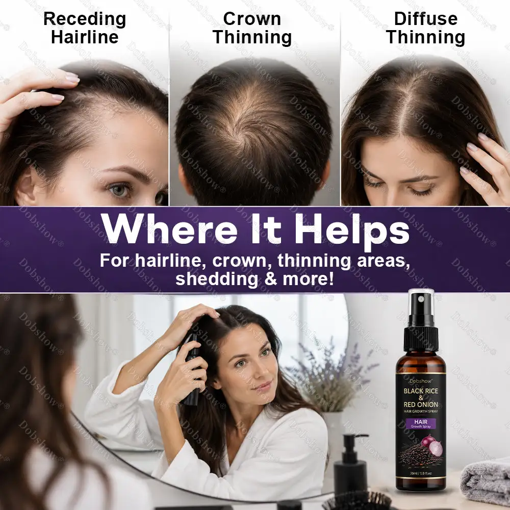 Black Rice & Red Onion Hair Growth Spray - Image 7