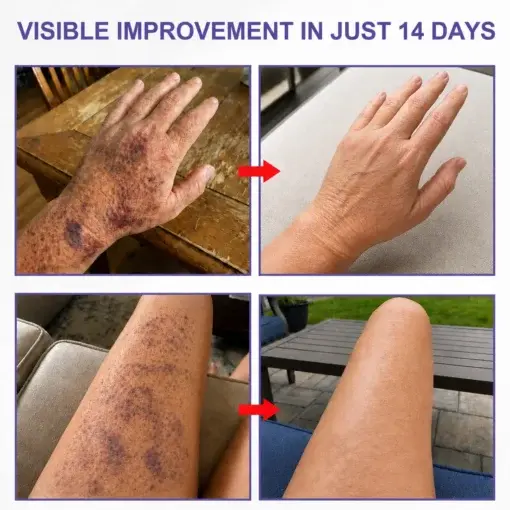 Dark Spot & Bruise Recovery Cream - Image 2