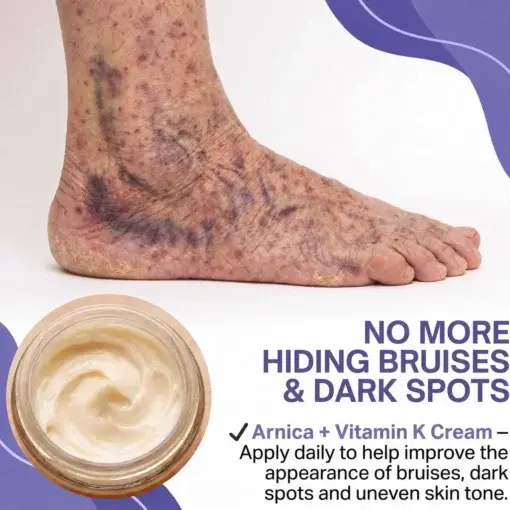 Dark Spot & Bruise Recovery Cream - Image 3