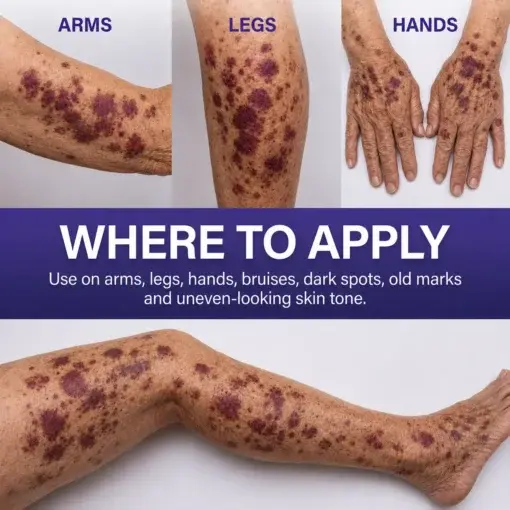 Dark Spot & Bruise Recovery Cream - Image 7