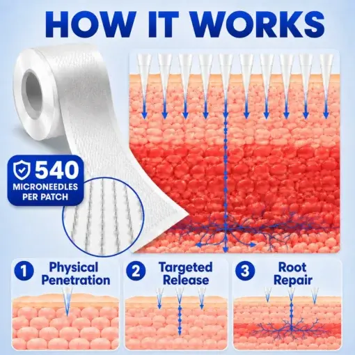 Micro Needle Patch Roll - Image 4